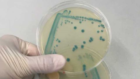 Why Some Listeria Strains Survive Good Food Hygiene Standards