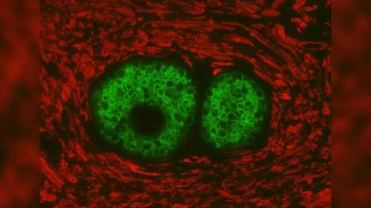 New Double-staining Kit Streamlines Immunofluorescence Workflow