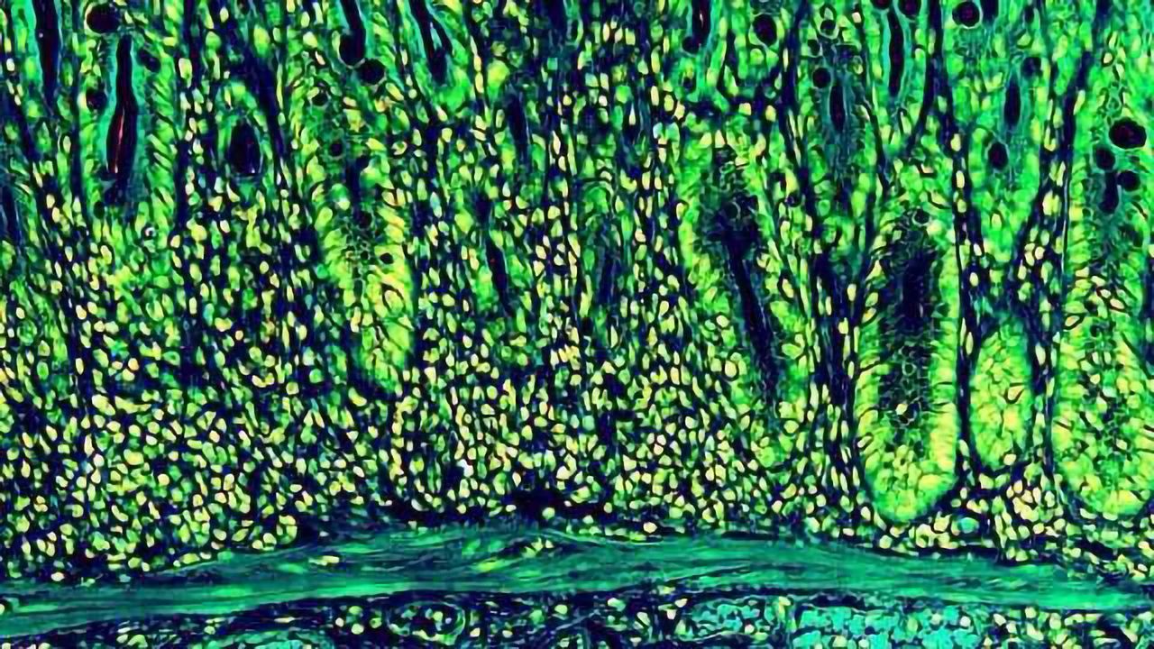 Immune and Nerve Cells Work Together to Fight Gut Infections