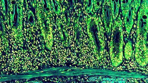 Immune and Nerve Cells Work Together to Fight Gut Infections