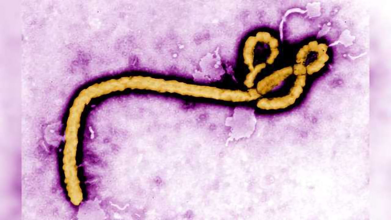 Ebola Vaccination: Study Assessing Immune Response Fuels Strategies for Improved Vaccine Development