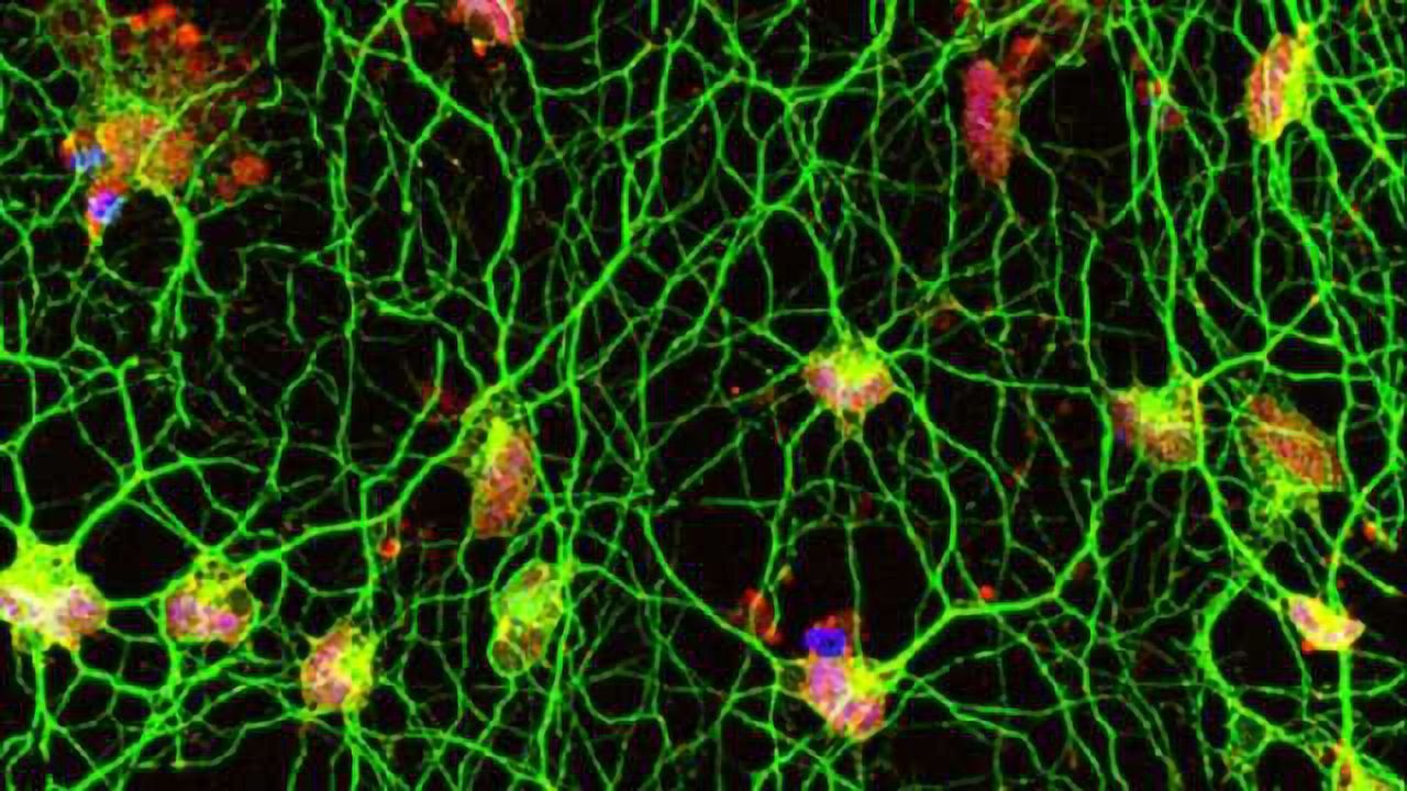 Skin Cells Directly Converted into Motor Neurons
