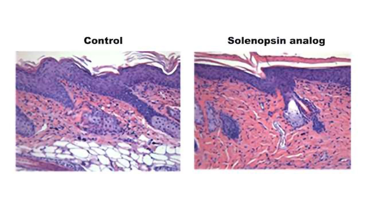 Could Venom Derived Compounds be Used to Treat Skin Inflammation?
