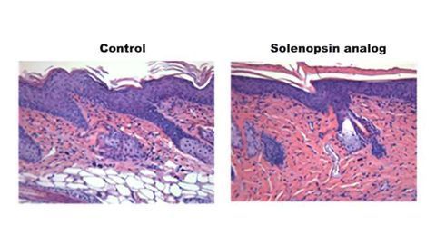 Could Venom Derived Compounds be Used to Treat Skin Inflammation?