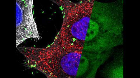 Sugar Molecule Helps Stomach Cells to Differentiate Between Good and Bad Bugs