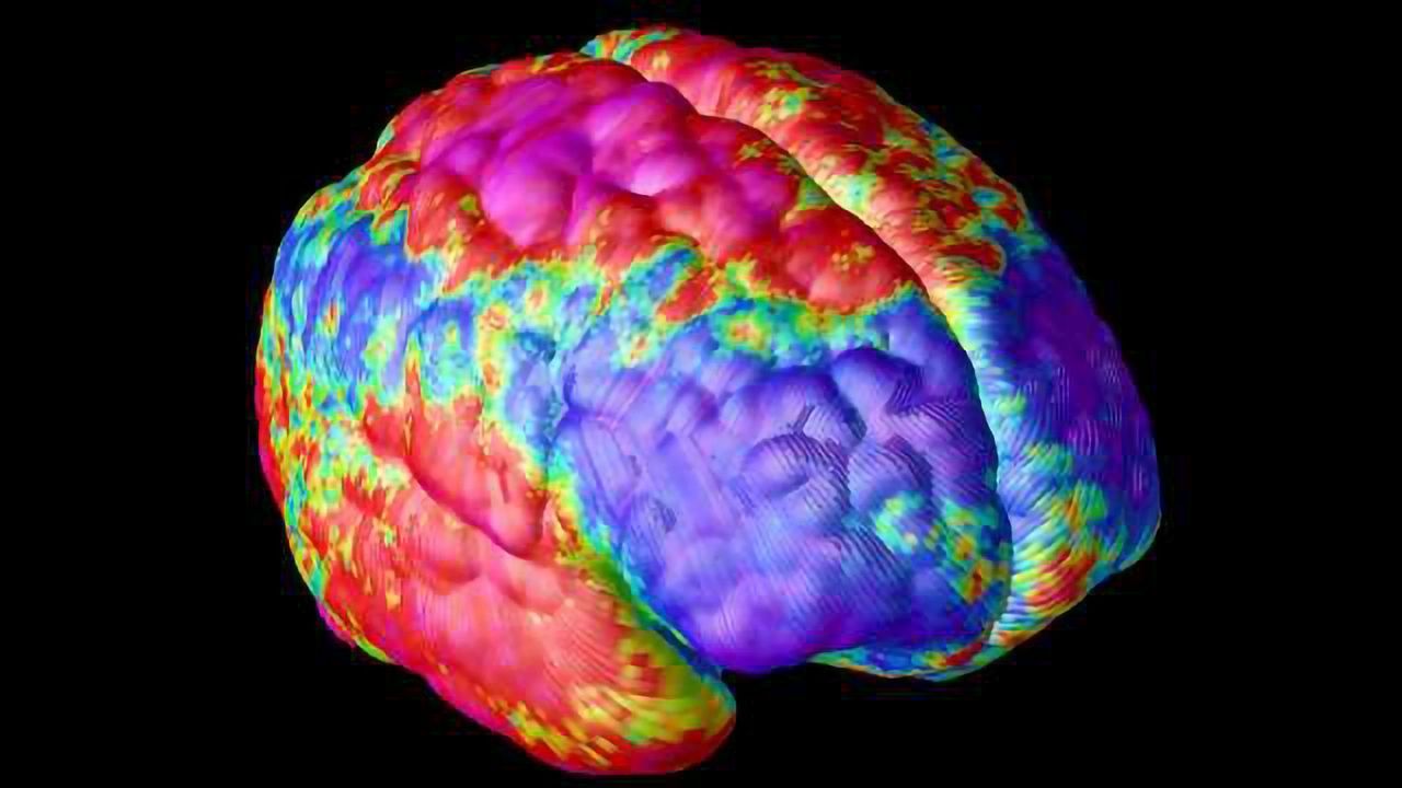 Rare Genetic Variant May Play Key Role in Schizophrenia