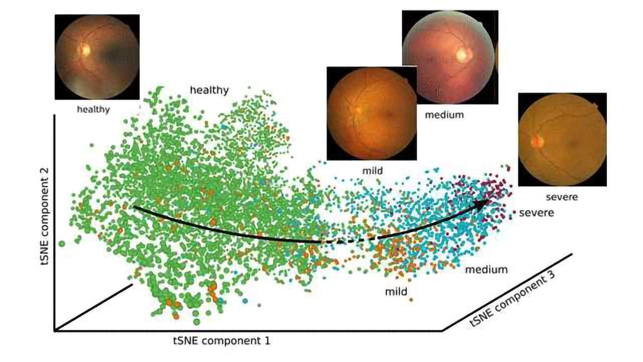 Reconstruction of Disease Progression Using Novel Deep Learning Method