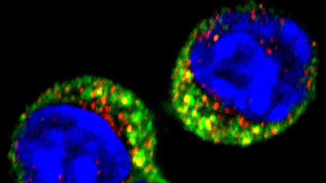 A Hair-trigger for Cells Fighting Infection