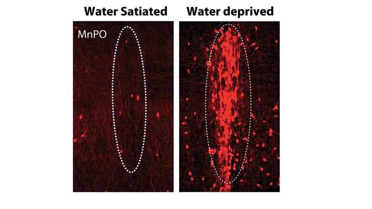 Study Identifies Neurons That Encode Thirst