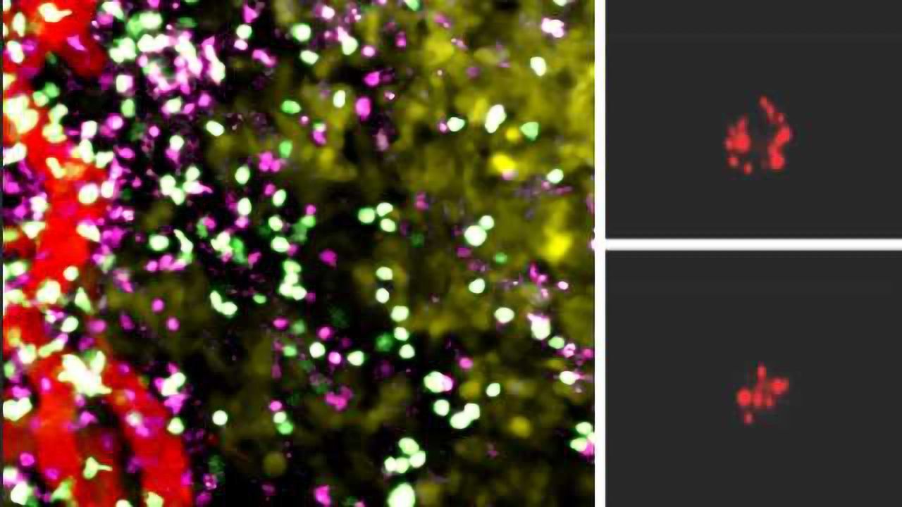 Cancer-fighting Cells Get a Boost from Oxygen Starvation Treatment