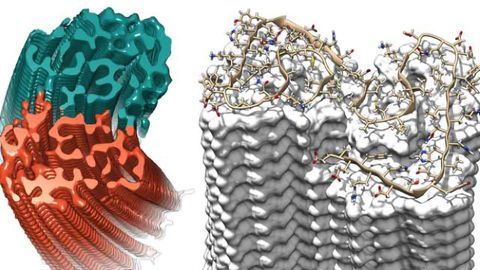 Sharpest Image of Alzheimer’s Fibrils Shows Previously Unknown Details