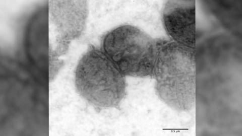 Promising Gonorrhea Vaccine Candidates Identified