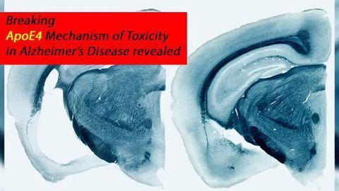 Mechanism of ApoE4 Gene Toxicity in Alzheimer's Disease Neurodegeneration Solved