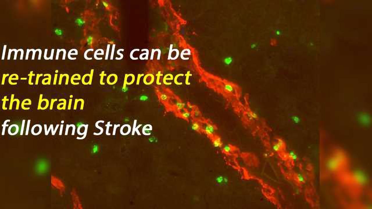Immune System Plays a Critical Role in Microvascular Repair Following Stroke