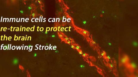 Immune System Plays a Critical Role in Microvascular Repair Following Stroke