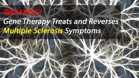 Gene Immunotherapy Approach Prevents and Reverses Symptoms of Multiple Sclerosis