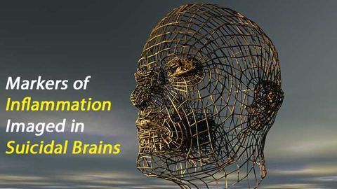 Inflammatory Markers Upregulated in Majorly Depressed Human Brains