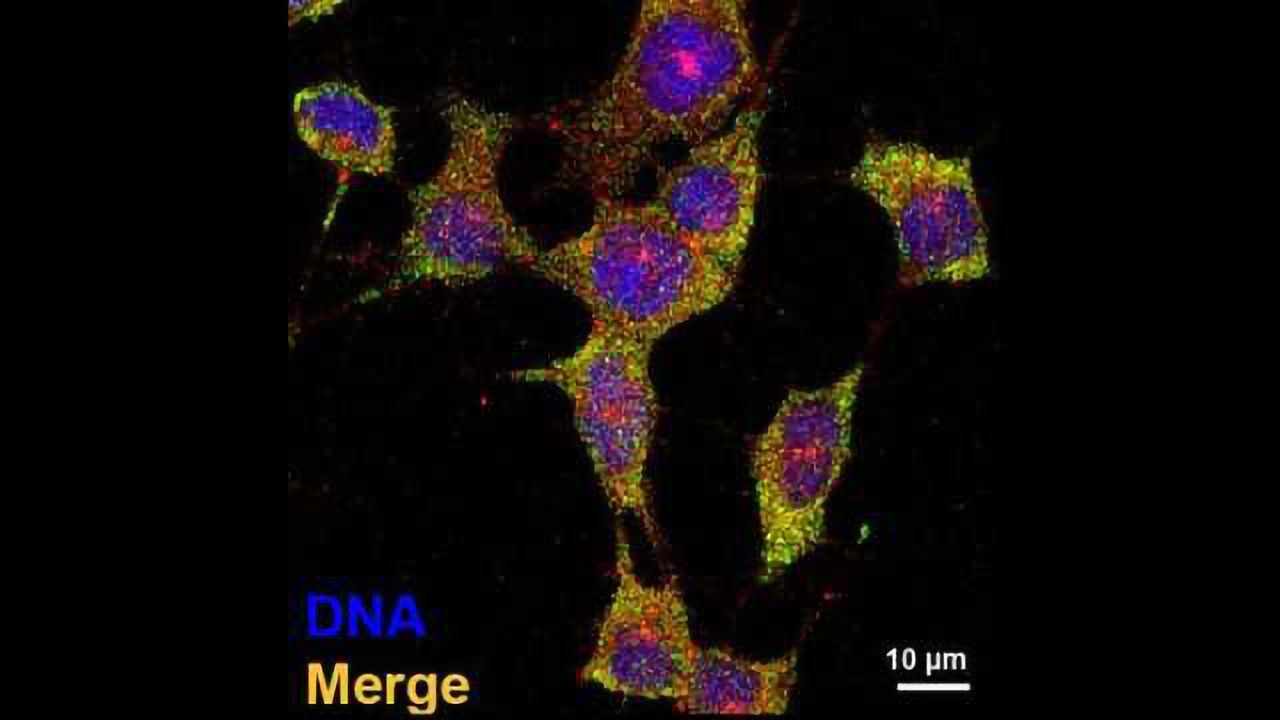 Gene Associated with Schizophrenia Risk May Regulate Neurodevelopment