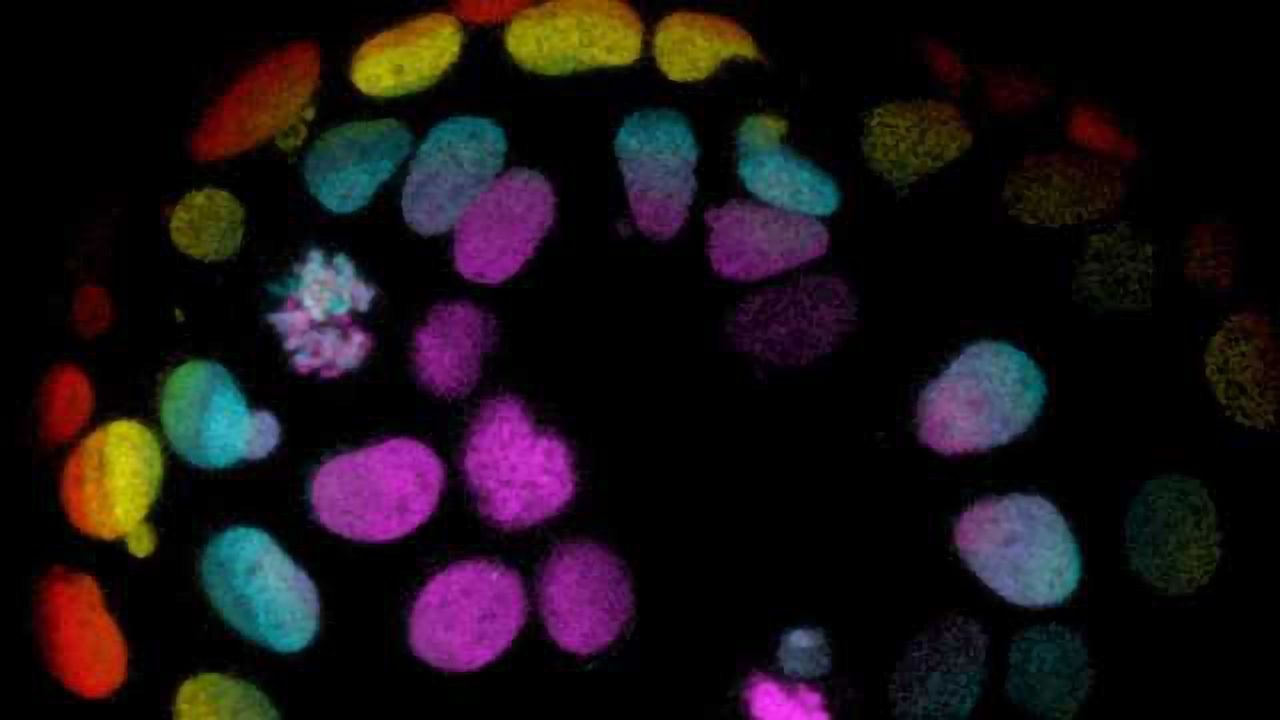 Organoids: The mini-organs advancing the study of human development and disease
