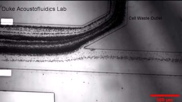 声波分离生物纳米颗粒的液体活检内容块的形象