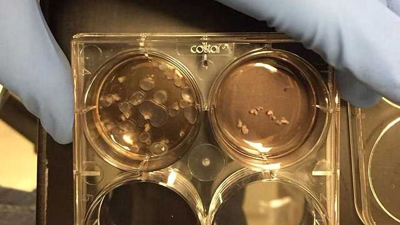 Mini-kidney Organoids Reveal Renal Disease Secrets