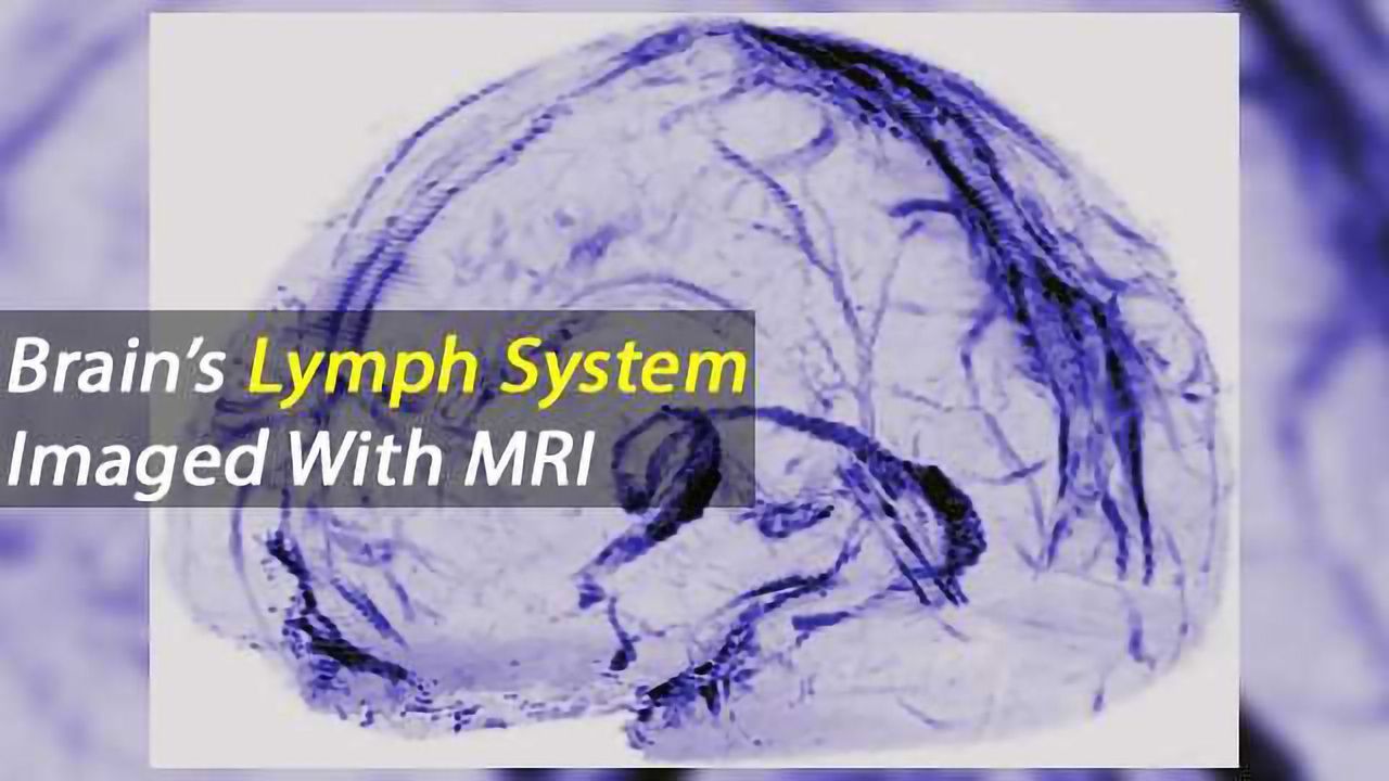 The Brain's Meninges Harbour its Lymphatic System