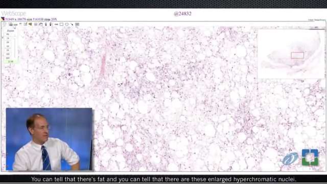 Pathology Insights: Soft Tissue Pathology with John Goldblum, MD content piece image 