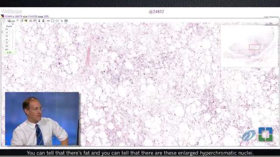 Pathology Insights: Soft Tissue Pathology with John Goldblum, MD content piece image