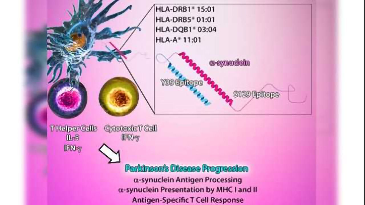 Imaging Parkinson's Disease