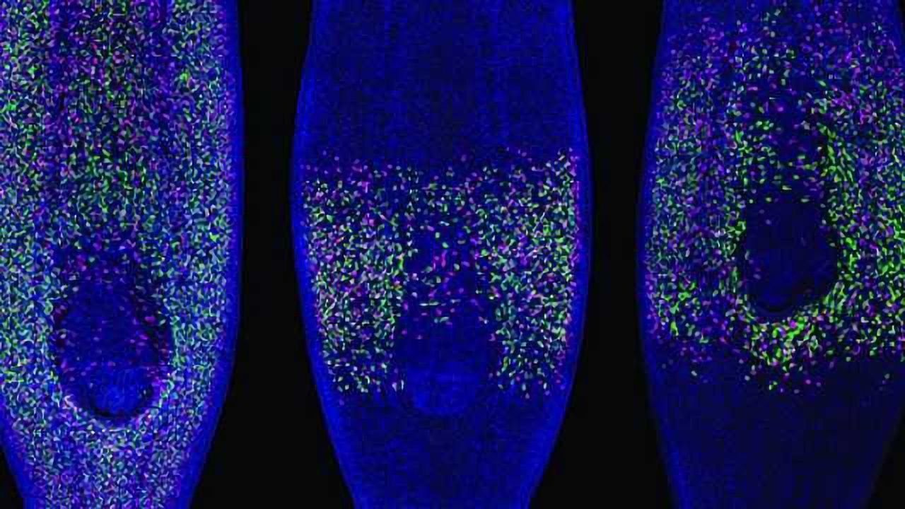 Worm Study Reveals Role of Stem Cells in Cancer