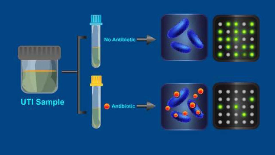 New Test Reveals AntibioticResistant Bacteria in 30 Minutes