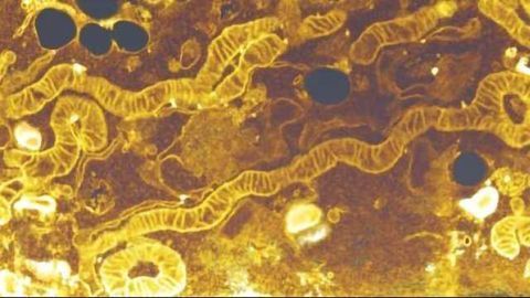 Why Can’t mTOR Inhibitors Kill Cancer?