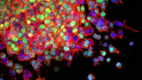 Study Challenges Oldest Observation in Cancer Metabolism