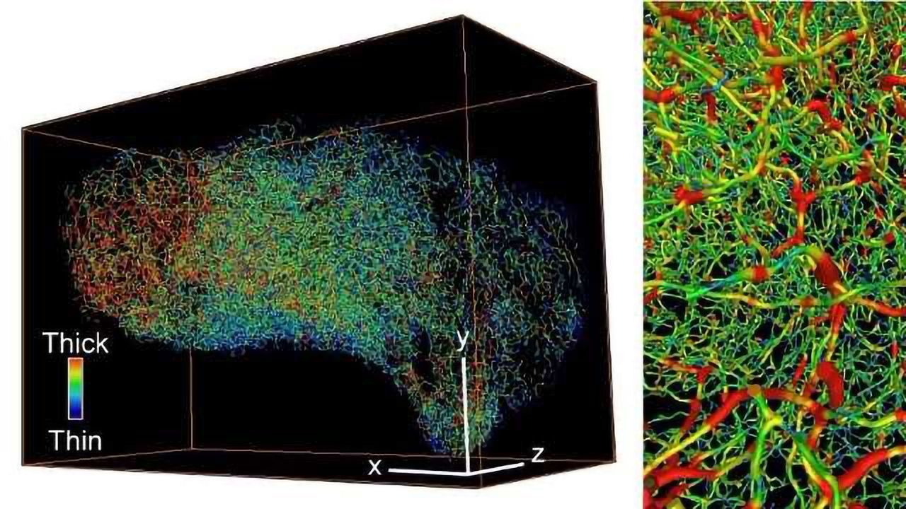 3D Microscopy Gives More Accurate Cancer Diagnosis