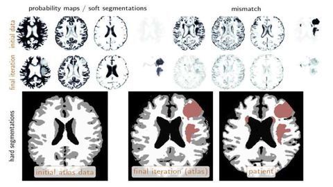 Ability to Identify Brain Tumors Using Machine Learning