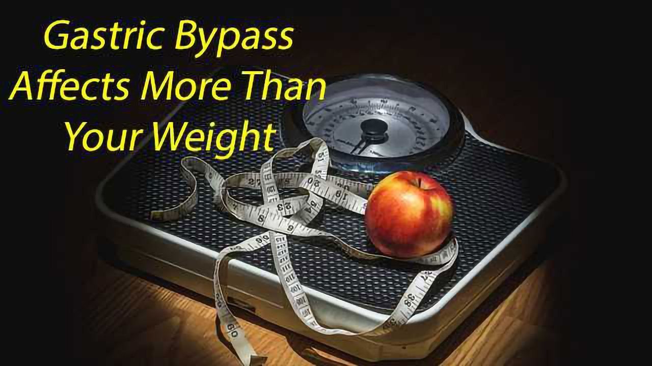 Advancing Technology Helps Understanding of Gastric Bypass Effectiveness
