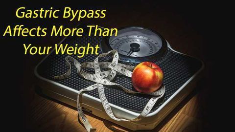 Advancing Technology Helps Understanding of Gastric Bypass Effectiveness