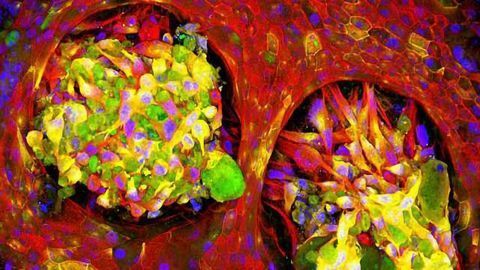 Lung Cancer-on-Chip Platforms Model NSCLC