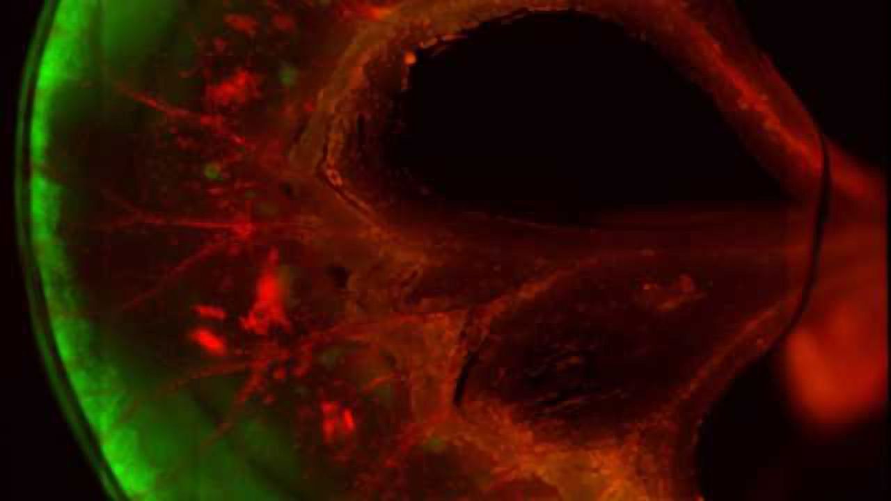 Functional, Stem-cell-derived Small Bowel Segments Created