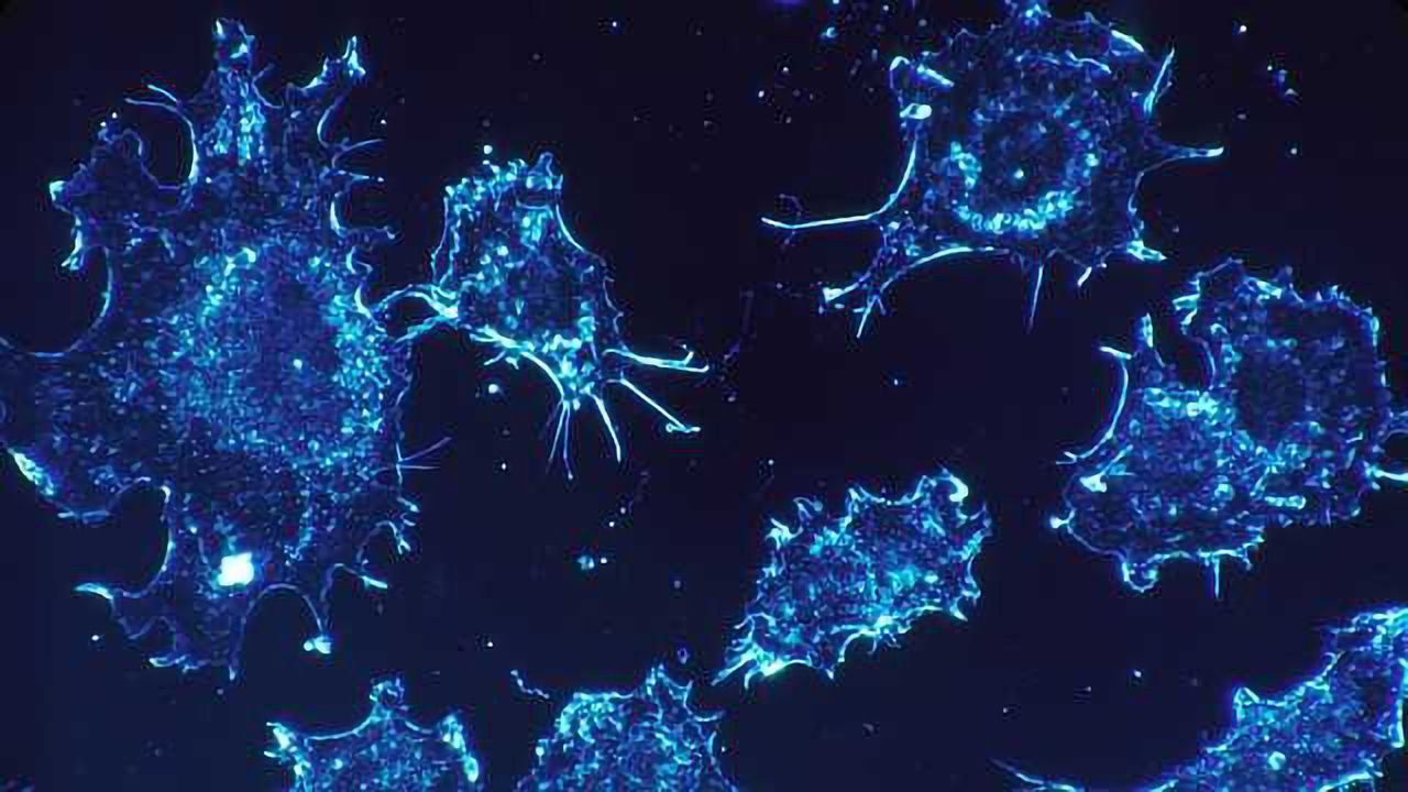 TOX protein identified in T-cell acute lymphoblastic leukemia development.