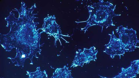 TOX protein identified in T-cell acute lymphoblastic leukemia development.