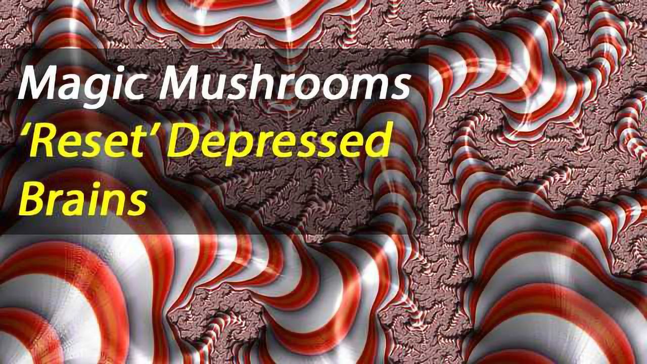 Psilocybin for Treatment-Resistant Depression