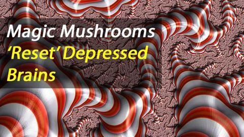 Psilocybin for Treatment-Resistant Depression