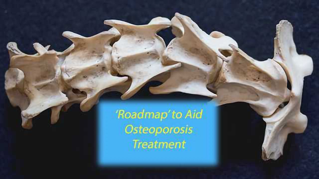 Osteoporosis Treatments Advanced by Mass Spectrometry Techniques