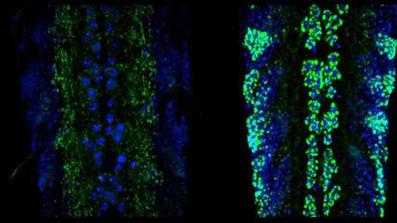 Pathway in Neurons may Contribute to Neurodegenerative Disease