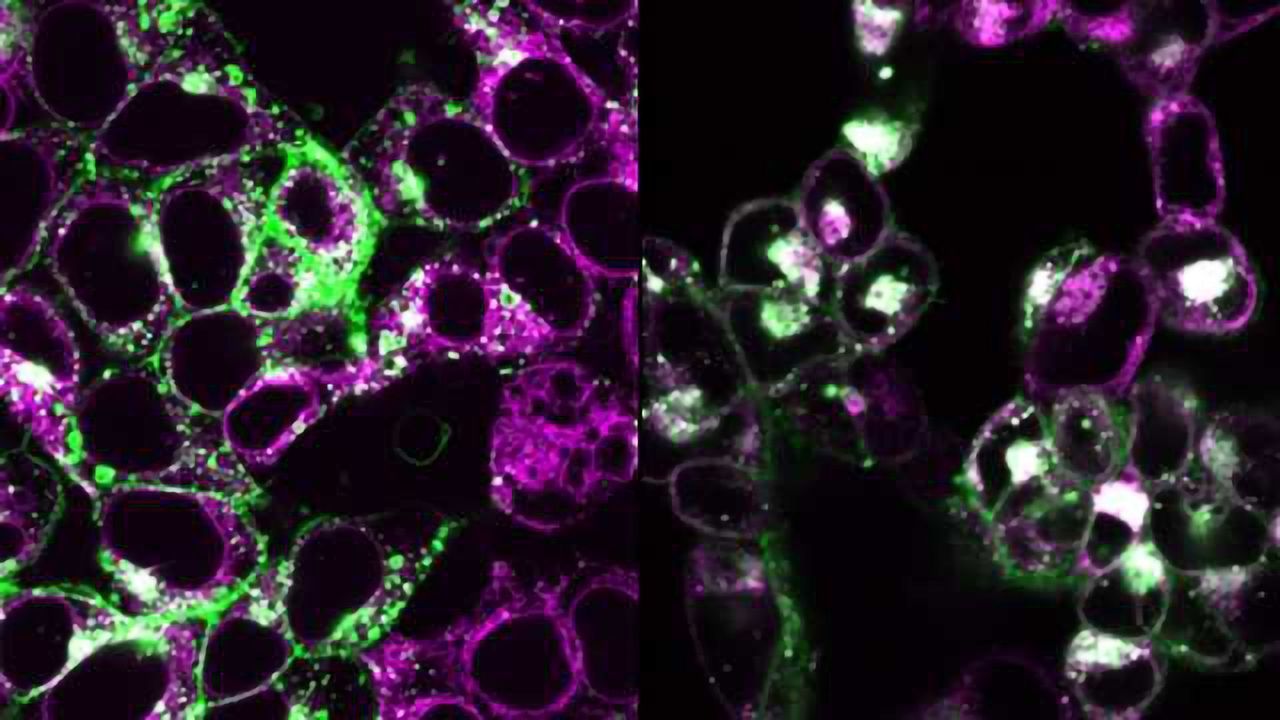 Mechanism Behind Inflammatory Response to Cytoplasmic DNA Identified