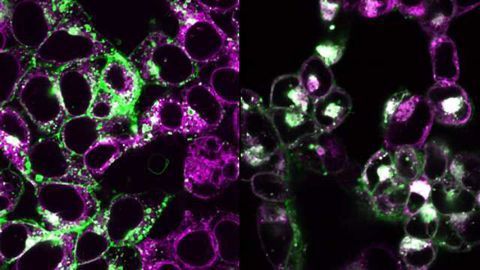 Mechanism Behind Inflammatory Response to Cytoplasmic DNA Identified
