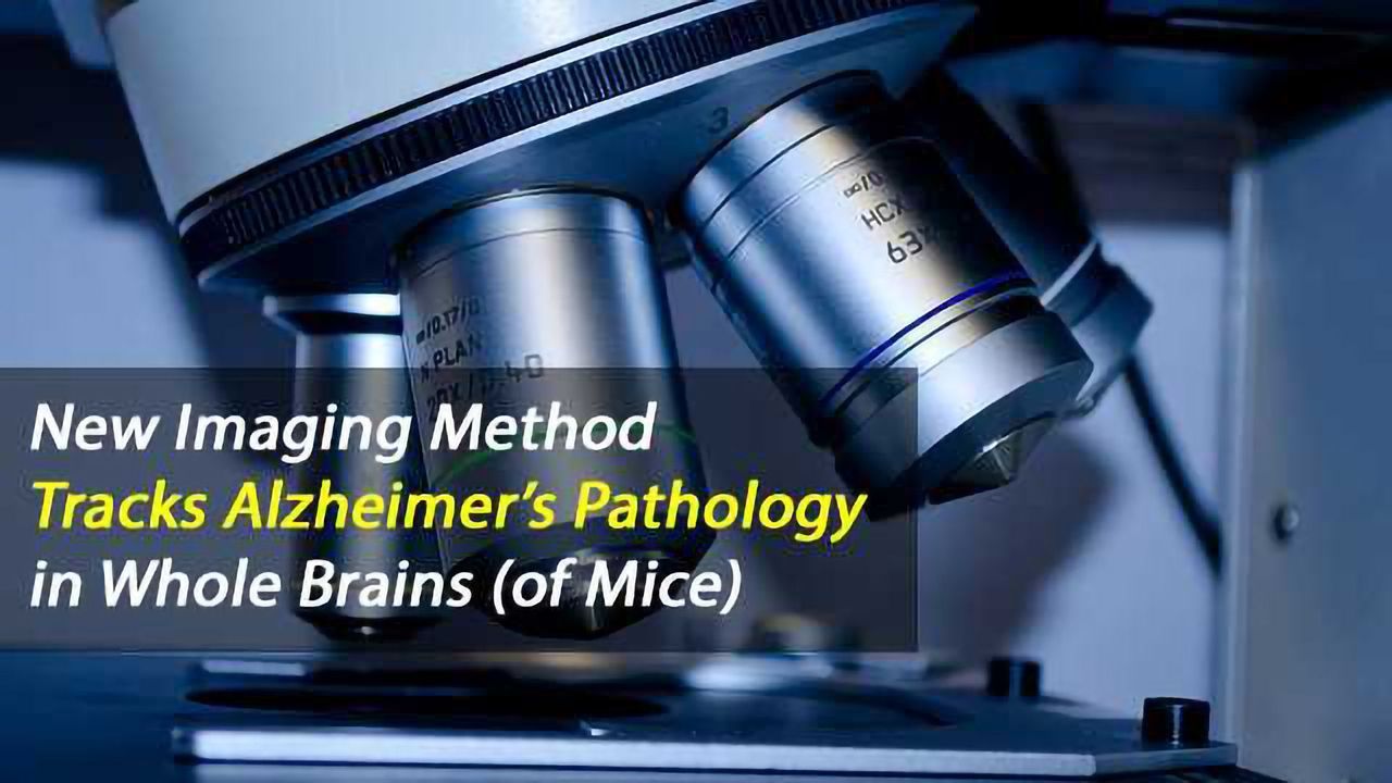 New Imaging Approach Maps Alzheimer's Pathology in the Whole Brain of Mice