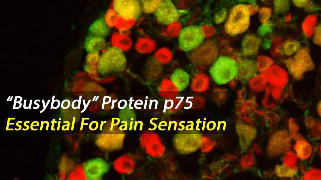 p75 Protein Essential For Pain Neuron Diversity