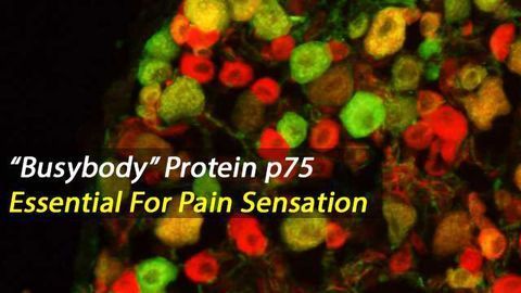 p75 Protein Essential For Pain Neuron Diversity